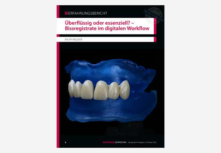 Artikel: Überflüssig oder essenziell? - Bissregistrate im digitalen Workflow